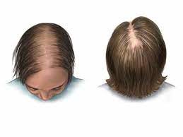 علاج فراغات الشعر الأمامية للنساء ب 5 خلطات طبيعية beauty sleep eye mask mask