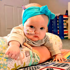 Baby with brain tumour 'hours from death' after doctors dismissed swollen  head as 'normal baby stuff'