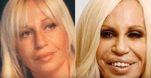 Sections show more follow today plastic surgery might not only help make people. 7 Celebrities Who Look Worse After Plastic Surgery Cosmeticium