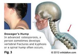 Pin On Ergonomics Posture