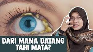 Contextual translation of tahi mata into english. Dari Mana Datang Tahi Mata Youtube