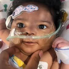 She's a miracle": A toddler who was bitten twice by a rattlesnake has  survived after receiving more than 30 vials of antivenom. MORE HERE
