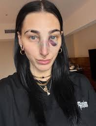 Beautiful but broken nose 👃got me weird 😪🥰❤️ #RheaRipley #rhearipleywwe  #rhearipleysbrutality #WWE