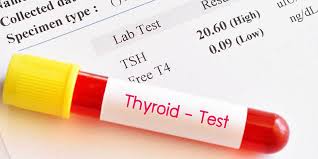 Image result for Thyroid Function Test