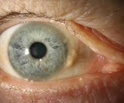 Image result for Scleria globonux