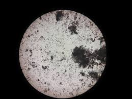 Amorphous Urate Crystal