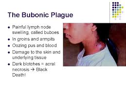 We did not find results for: The Black Death 1347 And On The Black