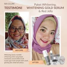paket skincare msglow