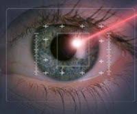 Lazerle Goz Ameliyati Nasil Yapilir Fiyatlari Ne Kadardir Laser Eye Surgery Eye Surgery Lasik Eye Surgery