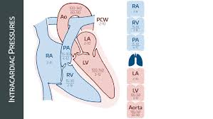 Image result for Cardiac Output