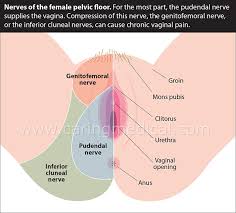 In human anatomy, the groin (the adjective is inguinal, as in inguinal canal) is the junctional area (also known as the inguinal region) between the abdomen and the thigh on either side of the pubic bone. Treatments For Groin Pain In Women Caring Medical Florida