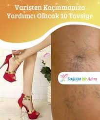 Bacaklardaki Orumcek Damarlar Icin Cozumler Guzellik Pinterest