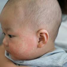 Frontiers in Pediatrics