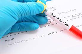 (analytical chemistry) the concentration of a substance as determined by titration. Ù…Ø§ Ù‡Ùˆ ØªØ­Ù„ÙŠÙ„ B Hcg Ù„Ù…Ø§Ø°Ø§ Ù‚Ø¯ ÙŠØ·Ù„Ø¨Ù‡ Ø§Ù„Ø·Ø¨ÙŠØ¨ ÙˆÙ…Ø§ ÙŠØ¬Ø¨ Ø¹Ù„Ù‰ Ø§Ù„Ù…Ø±ÙŠØ¶ Ù…Ø¹Ø±ÙØªÙ‡ Ø¹Ù† Ù‡Ø°Ø§ Ø§Ù„ØªØ­Ù„ÙŠÙ„