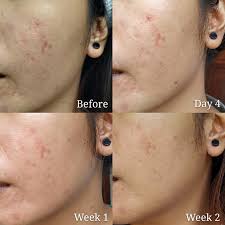 Pasalnya jika dibandingkan dengan luar negeri, jam masuk di indonesia termasuk yang paling pagi. Review 30 Hari Menggunakan Some By Mi Snail Truecica Miracle Repair Toner Your Wild Daisy