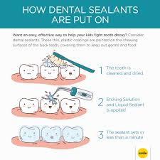 How Dental Sealants Are Applied To Your Teeth Salud Dental Salud Bucal Y Hechos Dentales