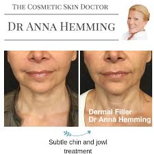 What A Difference Half And Hour Makes Did You Know That Your Face Symmetry Can Be Measured Using Equal Horizontal Obagi Skin Care Dermal Fillers Skin Health