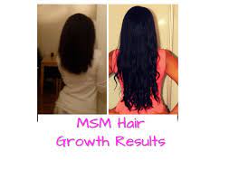 Apart from providing the chemicals that nourish hair follicles, msm was found to naturally increase the length of your hair's growth phase (anagen) by stimulating scalp circulation. Msm Hair Growth Before And After Pictures Msm Hair Growth Natural Hair Growth Hair Growth Oil
