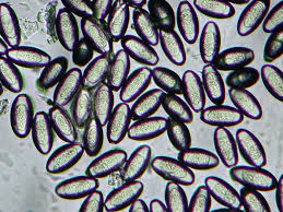 Image result for Pinworm