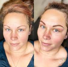 Leslie Wessinger DDS PLLC, 5 Doctors Park, Ste F, Asheville, NC 28801, US