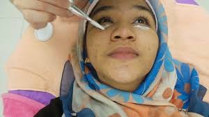 6,698 likes · 37 talking about this · 146 were here. Illy Ariffin Com Ko Skin Specialist Review Milia Seed Removal And Skin Peeling Treatment