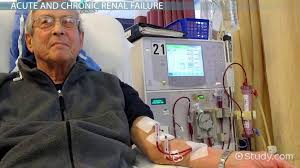 What can relieve kidney failure? What Is Renal Failure Definition Related Vocabulary Video Lesson Transcript Study Com