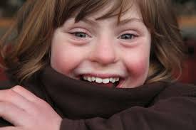 Potocki Lupski Syndrome Blog Rare Genomics Institute