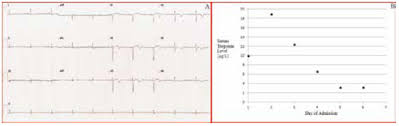 Racgp What Does An Elevated Troponin Mean An Update On