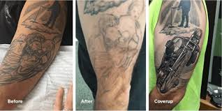 Try ointments such as tat b gone and wrecking balm. What To Know About Tattoo Lightening Removery