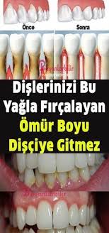 Aynur Kizilkanat Adli Kullanicinin Saglik Panosundaki Pin 2020 Dogal Dis Beyazlatma Herboloji Bitkisel Tarifler