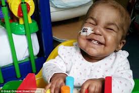 Bowel cancer, also known as colorectal cancer, usually affects the large intestine. Gosh Cure Two Babies With Terminal Cancer Daily Mail Online