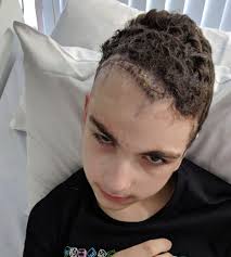 Teen had part of skull removed when sinus infection spread to brain