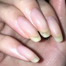 またスクエアオフに戻した 爪が傷んでてツライ 爪にいいサプリとか試してみようかな 素爪 ネイルベッド ハイポニキウム 育爪 トップコート セルフネイル フリーエッジ 自爪 スクエアオフ nails beauty