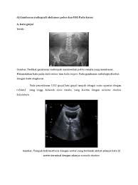 We did not find results for: 6 Gambaran Radiografi Abdomen Polos Dan Usg Pada Kasus