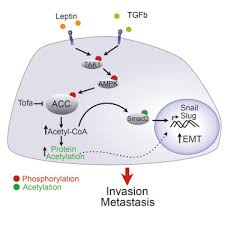 Check spelling or type a new query. Acetyl Coa Carboxylase 1 Dependent Protein Acetylation Controls Breast Cancer Metastasis And Recurrence Sciencedirect
