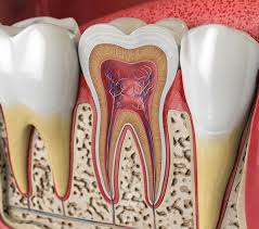 Scaling & Root Planing Hattiesburg & Columbia, MS | Cronin Family Dentistry