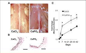 Calcium Chloride Induced Aneurysm Created Through The Application Of Download Scientific Diagram
