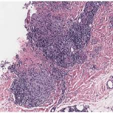 Judith Isaac-Renton's research works