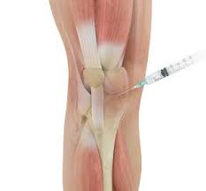 Image result for Cortisone