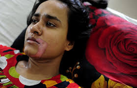 Maybe you would like to learn more about one of these? Bangladeshi Woman Forced To Drink Acid In Laws Booked Under Dowry Case Indian Women Blog Stories Of Indian Women