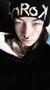 SNAKEBITES FINALLYYY !!!