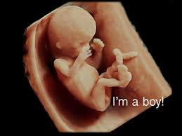 Maybe you would like to learn more about one of these? Image Gallery 4d Ultrasound Sarasota Florida 3d Ultrasound Sarasota Florida
