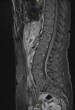Image result for Pseudoeriosema borianii