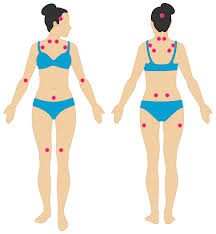 Pictures Of Fibromyalgia Symptoms