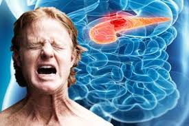 This symptom is a reason why pancreatic cancer patients may experience back pain. Pancreatic Cancer Symptoms Signs In Your Poo That Could Signal The Deadly Disease Express Co Uk