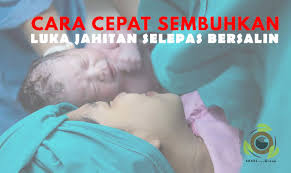 Lantas, salep antibiotik apa saja yang dapat digunakan sebagai salep untuk mengeringkan luka berair/bernanah tersebut? Cara Sembuhkan Luka Jahitan Selepas Bersalin Shaklieya Blog