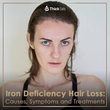 Namely, vitamin d stimulates the growth of follicles. Iron Deficiency Hair Loss Causes Symptoms And Treatments Thicktails