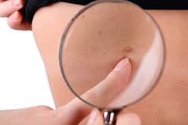 Image result for lumps