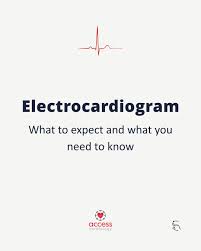 Image result for Electrocardiogram Validity