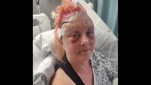 Fundraiser by Shaun Gegan : Fundraiser for Jenna Stevens, Whose Brain  Sabotaged Her